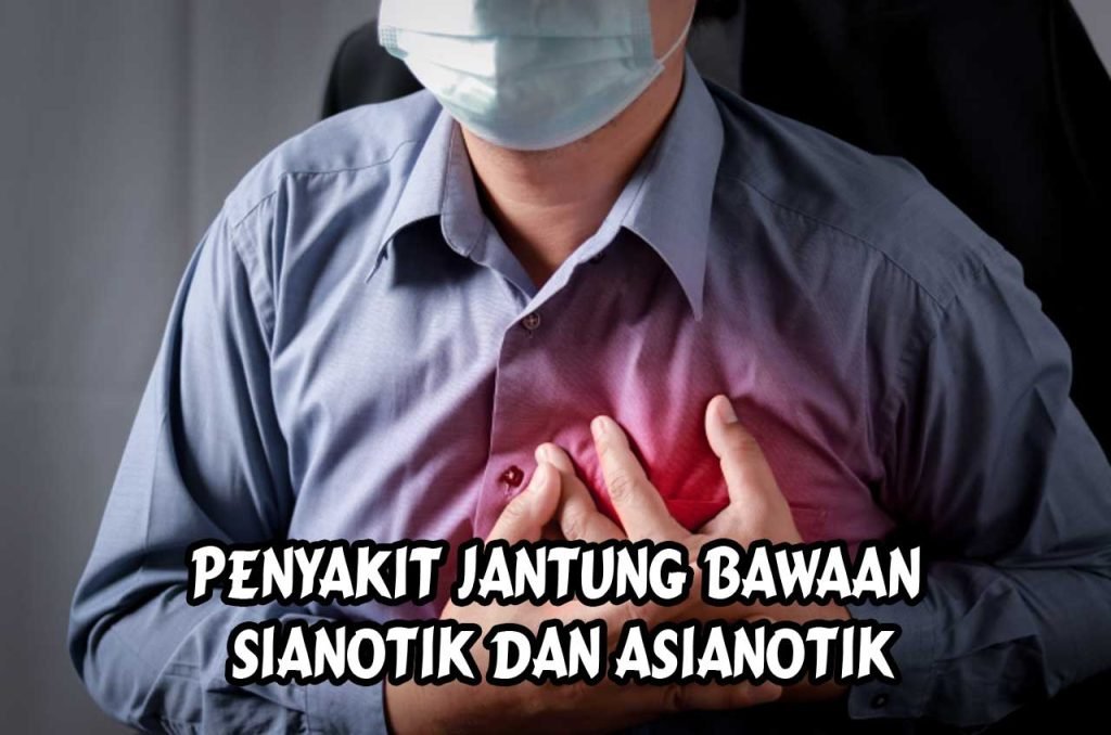 Penyakit Jantung Bawaan Sianotik dan Asianotik