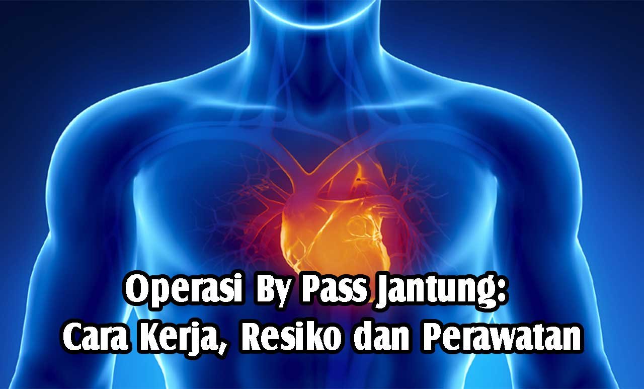 Operasi By Pass Jantung